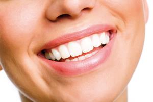 Picture of a smiling woman showing the results of having dental caps in Costa Rica