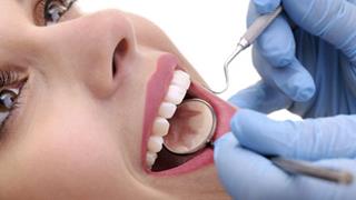 Picture of a smiling patient showing her having a periodontal treatment in Costa Rica