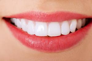 Close-up picture of a smiling woman showing her perfect teeth after having a veneers procedure in Costa Rica